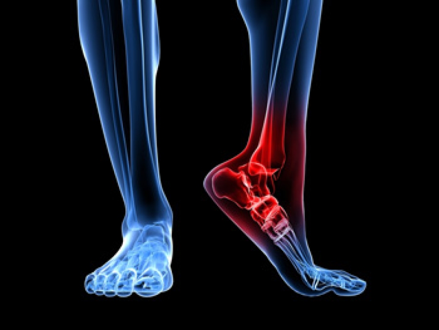 Types of clearance heel pain